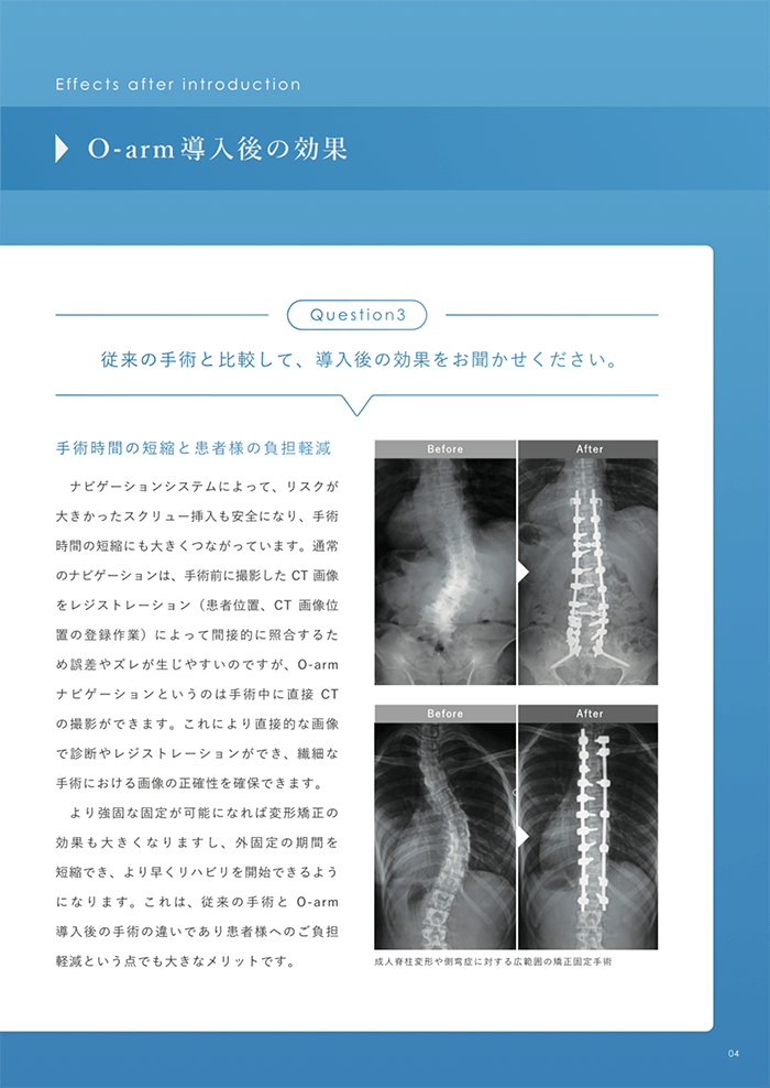o-arm パンフレット画像その5