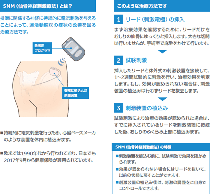 (SNM)仙⾻神経刺激療法とは?